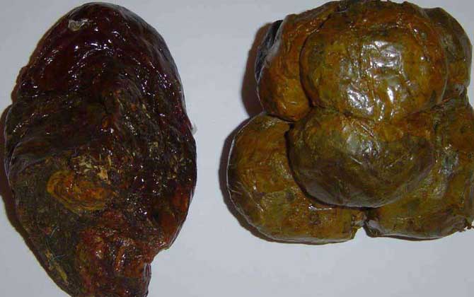 蜂膠和蜂王漿的區別 蜂膠