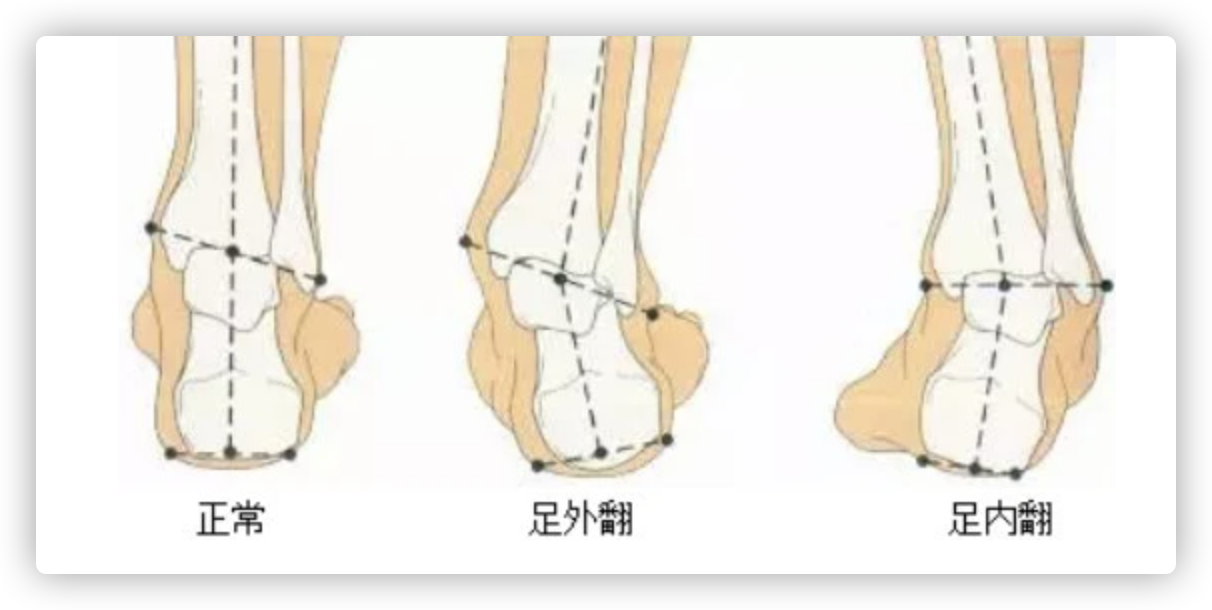 真正懂跑步的人,都買(mǎi)了什么樣的跑步鞋 選鞋不求人——這篇文章告訴你跑鞋到底怎么選