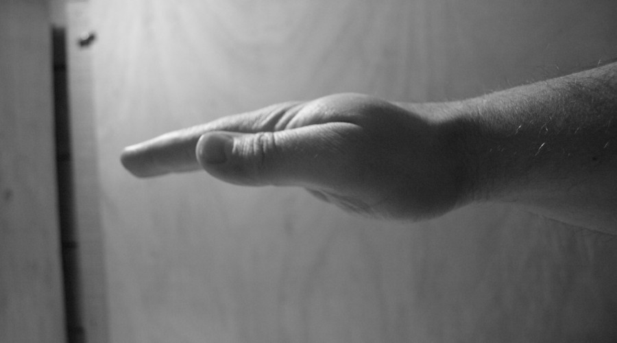 讓馬蜂蟄了最佳消腫法(最快消腫止痛止癢方法) 讓馬蜂蟄了最佳消腫法(最快消腫止痛止癢方法)